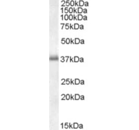 Western Blot - Anti-LAT Antibody (A82624) - Antibodies.com