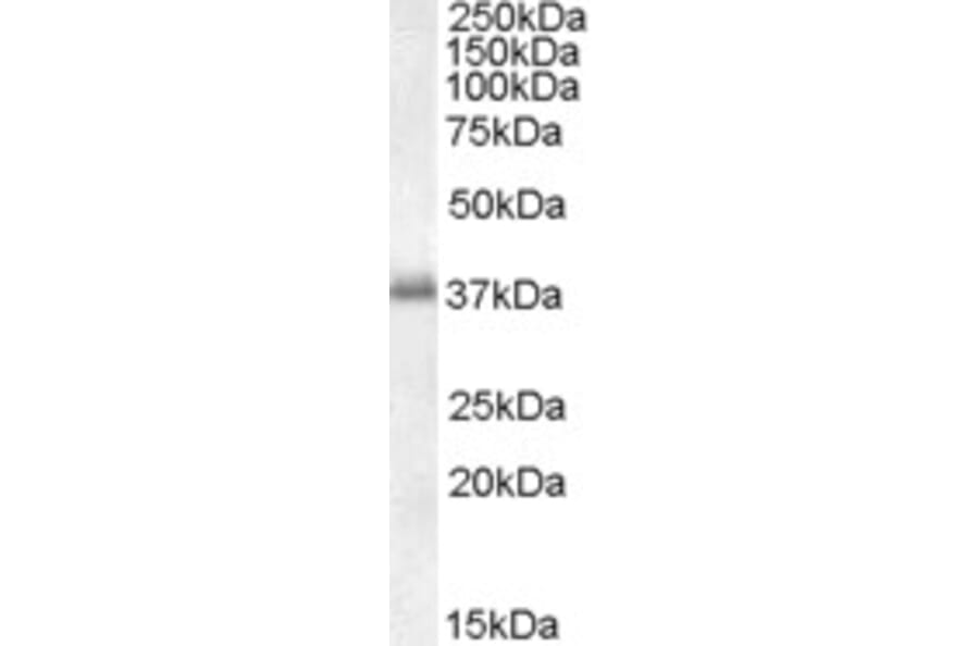 Western Blot - Anti-LAT Antibody (A82624) - Antibodies.com