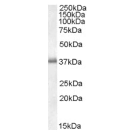 Western Blot - Anti-LAT Antibody (A82624) - Antibodies.com