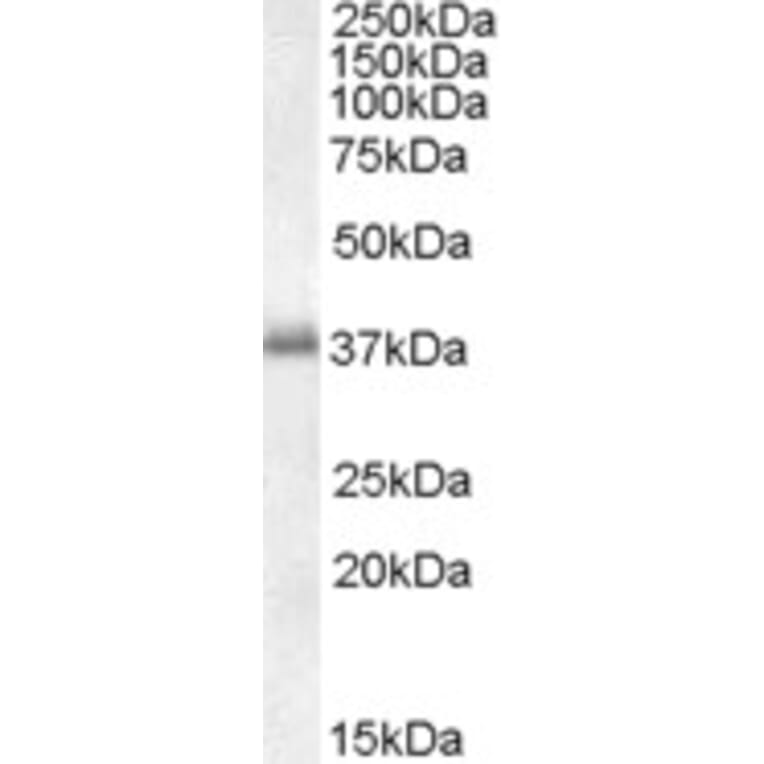 Western Blot - Anti-LAT Antibody (A82624) - Antibodies.com