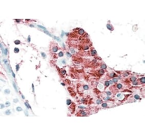 Immunohistochemistry - Anti-TIAM2 Antibody (A82625) - Antibodies.com