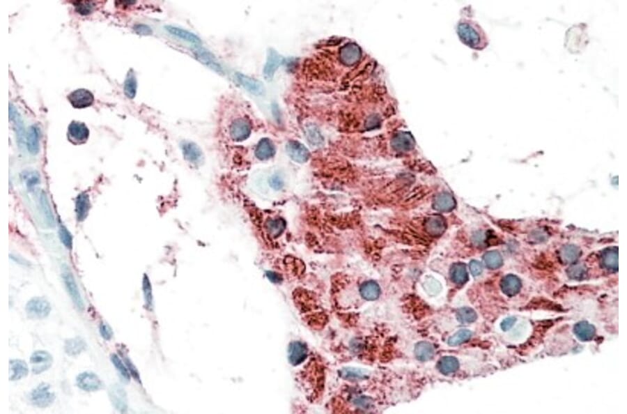 Immunohistochemistry - Anti-TIAM2 Antibody (A82625) - Antibodies.com