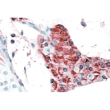 Immunohistochemistry - Anti-TIAM2 Antibody (A82625) - Antibodies.com