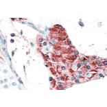 Immunohistochemistry - Anti-TIAM2 Antibody (A82625) - Antibodies.com