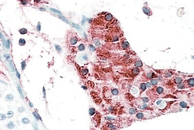 Anti-TIAM2 Antibody (A82625) (5µg/ml) staining of paraffin embedded Human Testis. Steamed antigen retrieval with citrate buffer pH 6, AP-staining.