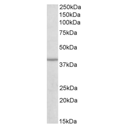 Western Blot - Anti-IDH3B Antibody (A82627) - Antibodies.com