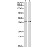 Western Blot - Anti-IDH3B Antibody (A82627) - Antibodies.com