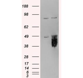 Western Blot - Anti-TFPI Antibody (A82628) - Antibodies.com