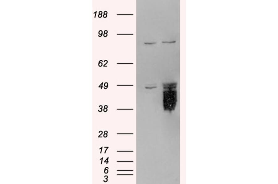 Western Blot - Anti-TFPI Antibody (A82628) - Antibodies.com