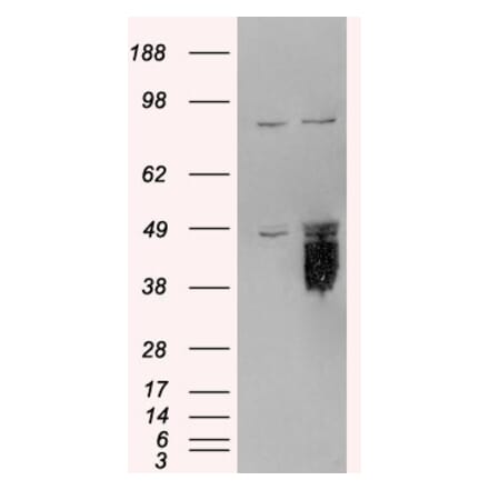 Western Blot - Anti-TFPI Antibody (A82628) - Antibodies.com