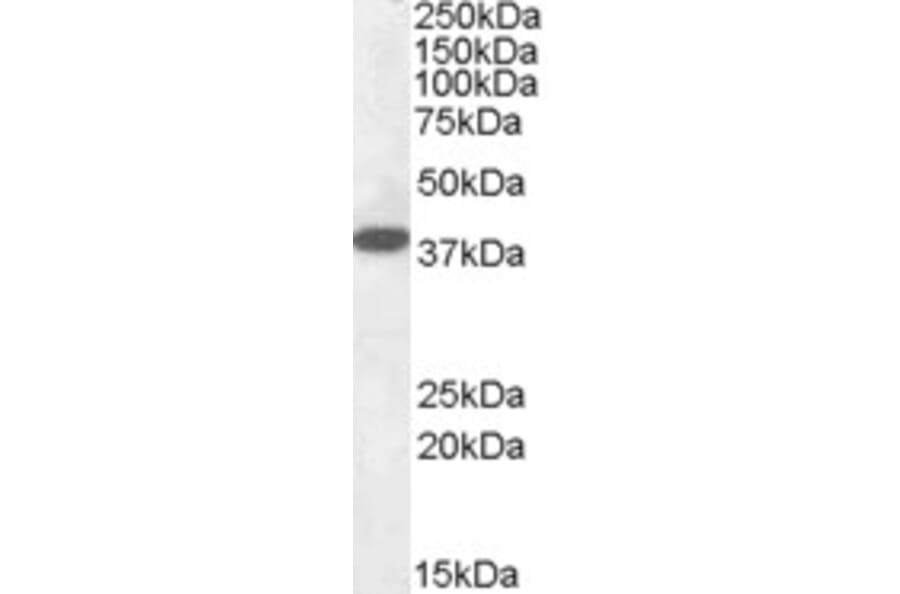Western Blot - Anti-EPM2A/Laforin Antibody (A82629) - Antibodies.com