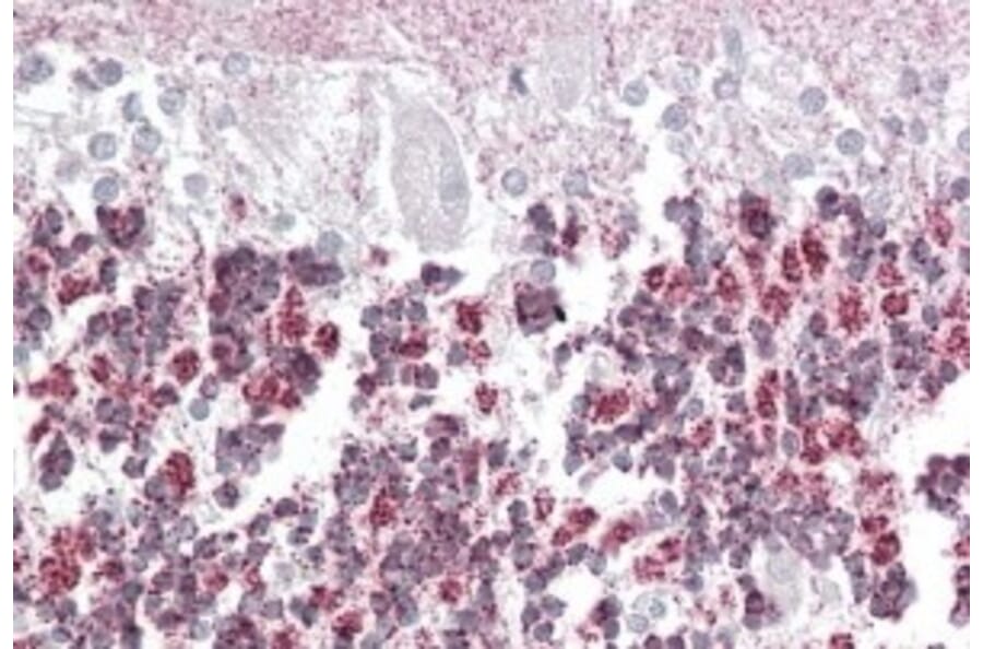 Immunohistochemistry - Anti-EPM2A/Laforin Antibody (A82629) - Antibodies.com