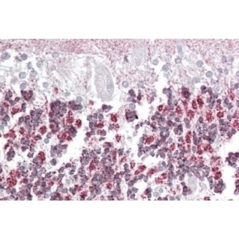 Immunohistochemistry - Anti-EPM2A/Laforin Antibody (A82629) - Antibodies.com