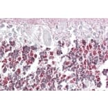 Immunohistochemistry - Anti-EPM2A/Laforin Antibody (A82629) - Antibodies.com