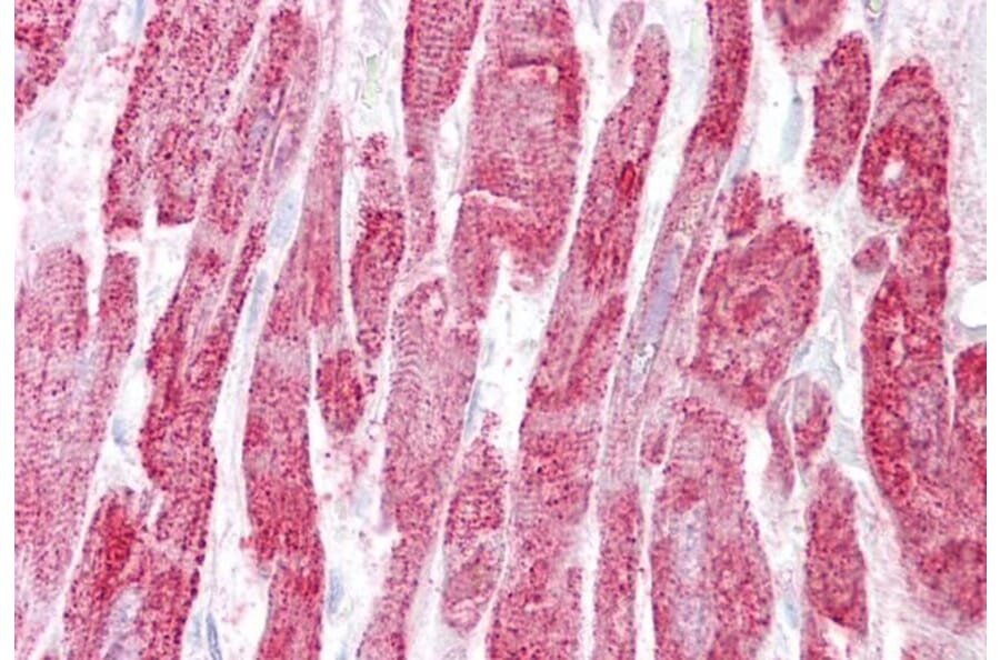 Immunohistochemistry - Anti-EPM2A/Laforin Antibody (A82629) - Antibodies.com