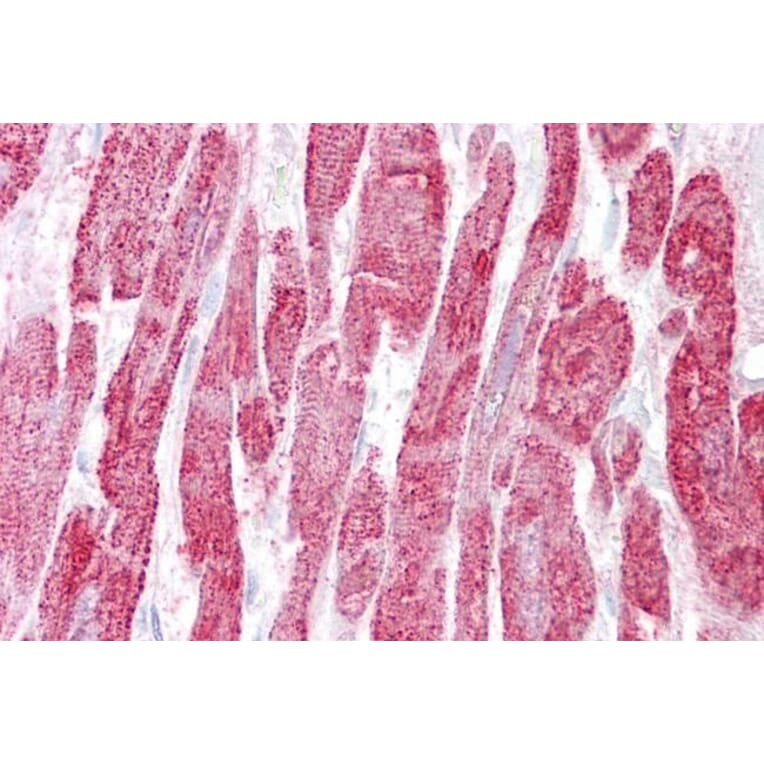 Immunohistochemistry - Anti-EPM2A/Laforin Antibody (A82629) - Antibodies.com