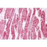 Immunohistochemistry - Anti-EPM2A/Laforin Antibody (A82629) - Antibodies.com