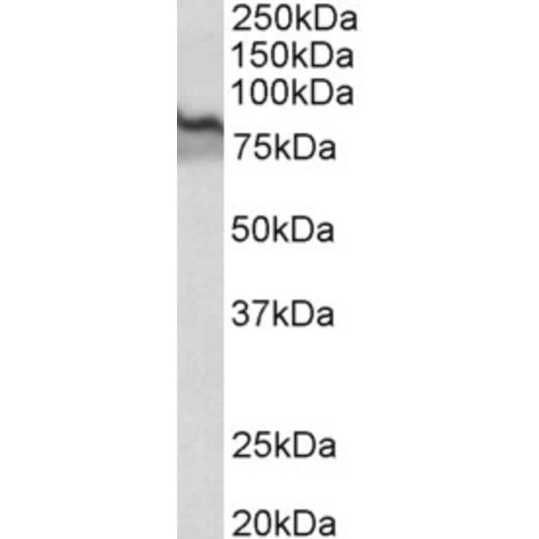 Western Blot - Anti-Transglutaminase 2 Antibody (A82631) - Antibodies.com