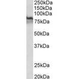 Western Blot - Anti-Transglutaminase 2 Antibody (A82631) - Antibodies.com