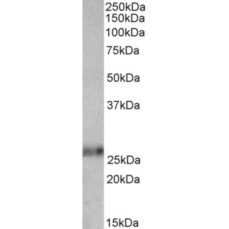 Western Blot - Anti-Ephrin A1 Antibody (A82632) - Antibodies.com