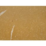 Immunohistochemistry - Anti-Munc18-1 Antibody (A82633) - Antibodies.com