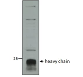 Western Blot - Anti-Cathepsin C Antibody (A82634) - Antibodies.com