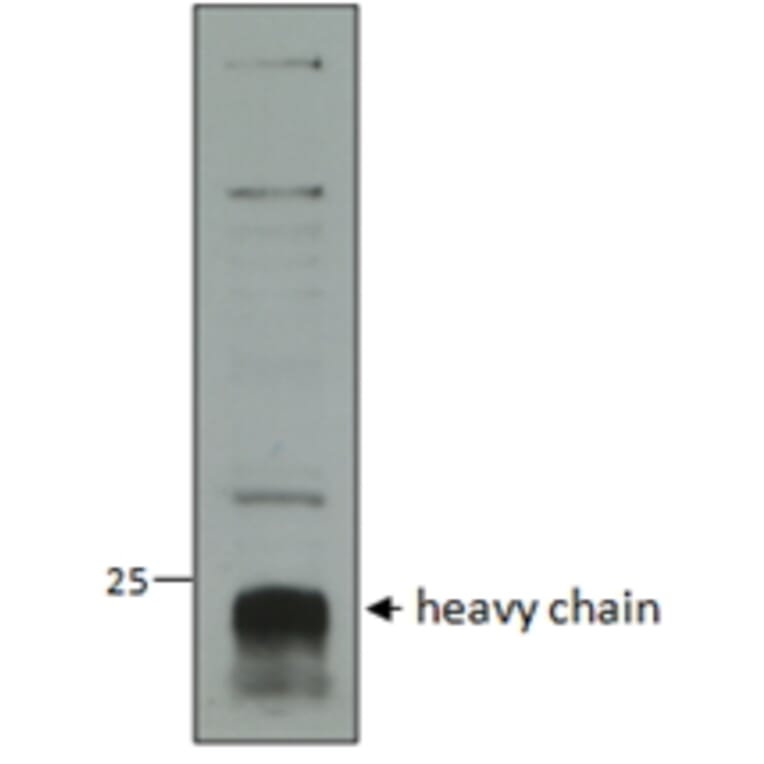 Western Blot - Anti-Cathepsin C Antibody (A82634) - Antibodies.com