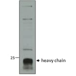 Western Blot - Anti-Cathepsin C Antibody (A82634) - Antibodies.com