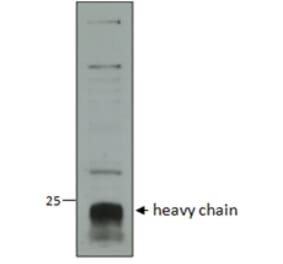 Western Blot - Anti-CTSC Antibody (A82634)