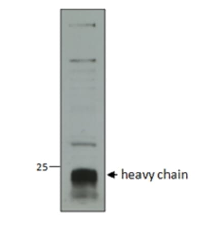 Western Blot - Anti-CTSC Antibody (A82634)