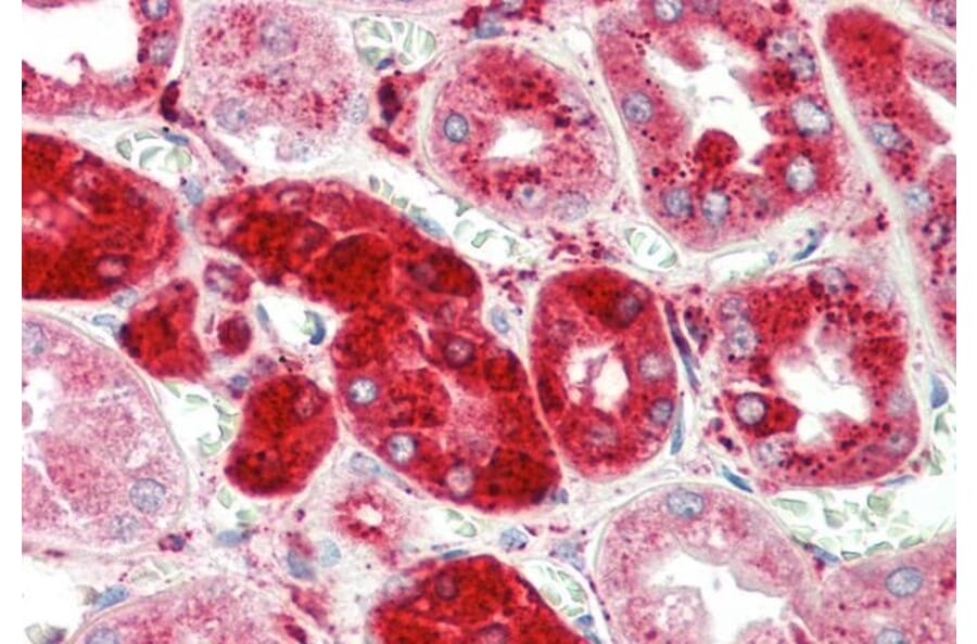 Immunohistochemistry - Anti-Cathepsin C Antibody (A82634) - Antibodies.com