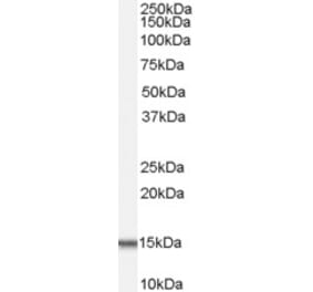 Western Blot - Anti-ACYP1 Antibody (A82635) - Antibodies.com