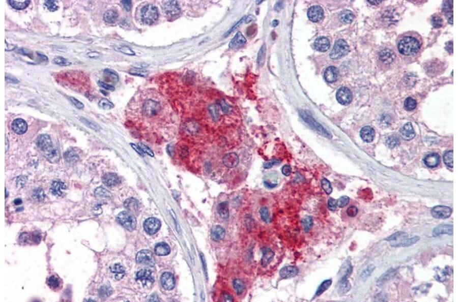 Immunohistochemistry - Anti-ACYP1 Antibody (A82635) - Antibodies.com