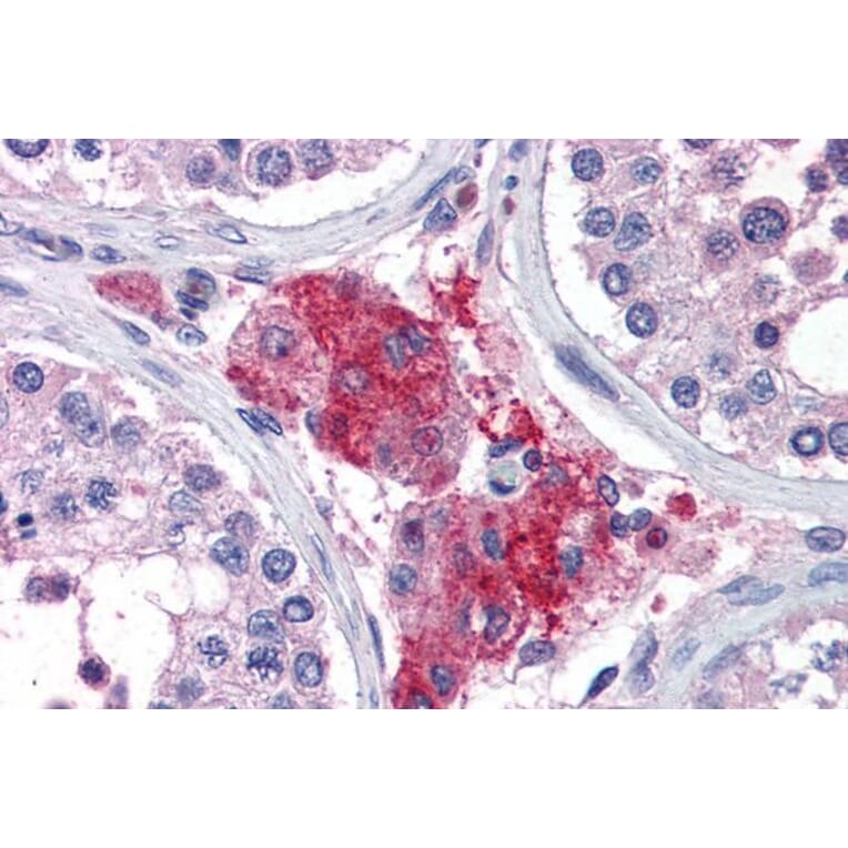 Immunohistochemistry - Anti-ACYP1 Antibody (A82635) - Antibodies.com