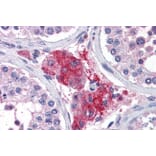 Immunohistochemistry - Anti-ACYP1 Antibody (A82635) - Antibodies.com