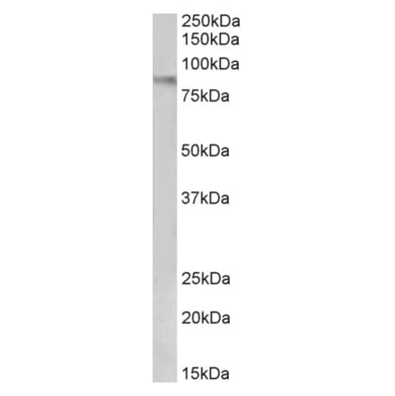 Western Blot - Anti-VCAM1 Antibody (A82636) - Antibodies.com