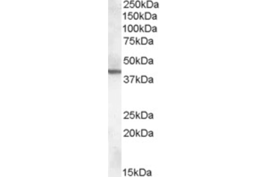 Western Blot - Anti-ABHD12 Antibody (A82637) - Antibodies.com