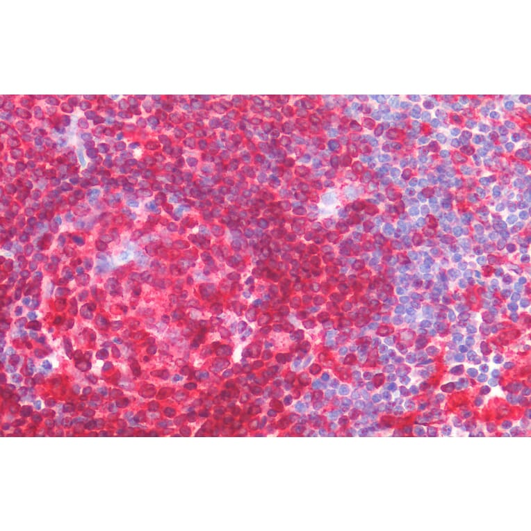 Immunohistochemistry - Anti-CD74 Antibody (A82638) - Antibodies.com