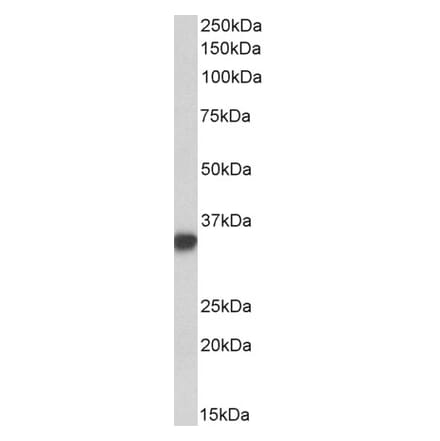 Western Blot - Anti-CD74 Antibody (A82639) - Antibodies.com