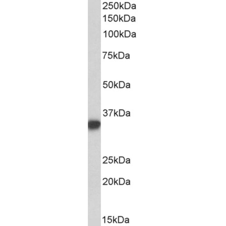 Western Blot - Anti-CD74 Antibody (A82639) - Antibodies.com