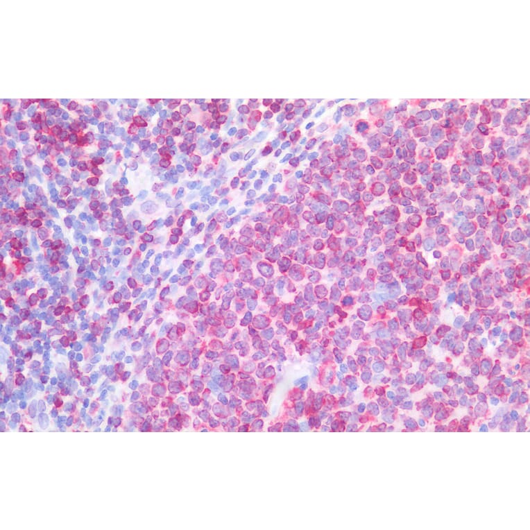 Immunohistochemistry - Anti-CD74 Antibody (A82639) - Antibodies.com