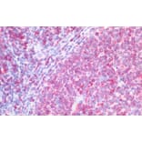 Immunohistochemistry - Anti-CD74 Antibody (A82639) - Antibodies.com
