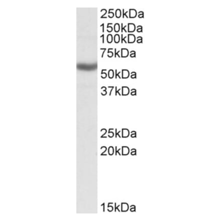 Western Blot - Anti-ALDH3B1 Antibody (A82641) - Antibodies.com