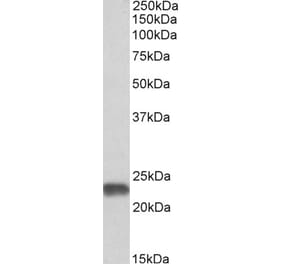 Western Blot - Anti-SOD2/MnSOD Antibody (A82642) - Antibodies.com