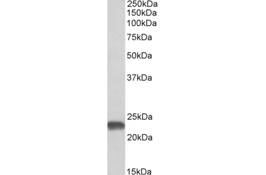 Western Blot - Anti-SOD2/MnSOD Antibody (A82642) - Antibodies.com