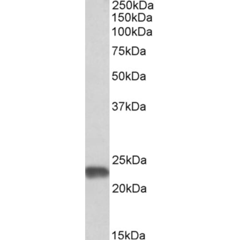 Western Blot - Anti-SOD2/MnSOD Antibody (A82642) - Antibodies.com