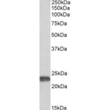 Western Blot - Anti-SOD2/MnSOD Antibody (A82642) - Antibodies.com