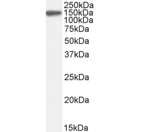 Western Blot - Anti-Factor H Antibody (A82643) - Antibodies.com