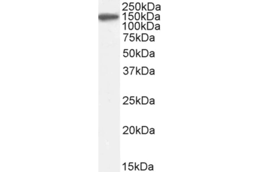 Western Blot - Anti-Factor H Antibody (A82643) - Antibodies.com