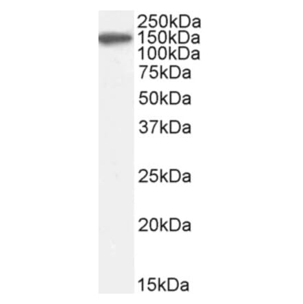 Western Blot - Anti-Factor H Antibody (A82643) - Antibodies.com